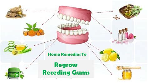 Health Remedies Make Receding Gums Grow Again And Fast With These
