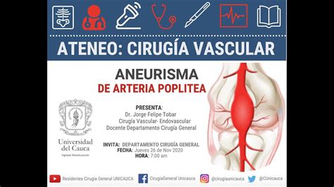 Ateneo Aneurisma De Arteria Poplitea Youtube