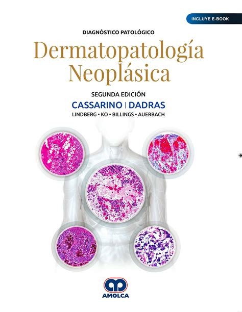 Diagnóstico Patológico Dermatopatología Neoplásica Incluye E Book