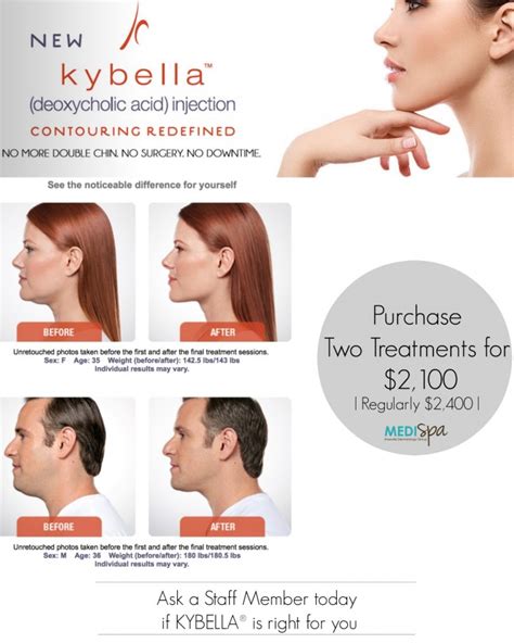 Medispa Knoxville Dermatology Announcing Kybella®