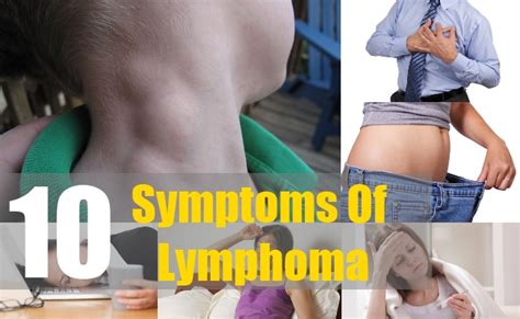 Top 10 Symptoms Of Lymphoma Natural Home Remedies And Supplements