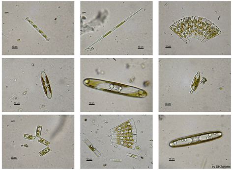 Microorganisms Taking A Look At Pond Water Organisms