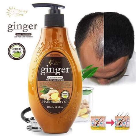 merry sun ginger anti hair loss shampoo shopee philippines