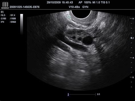 The solution is to implement something that is able to detect the transition of our input signal: M7 Premium | Ultrasound General Imaging Systems| Mindray India