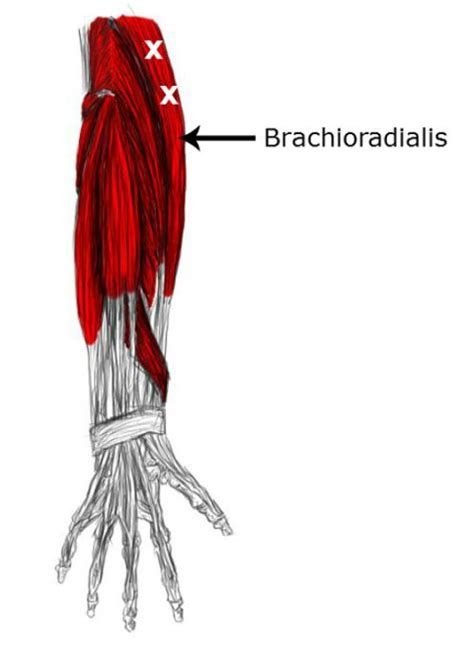 Brachioradialis Muscle Pain And Trigger Points