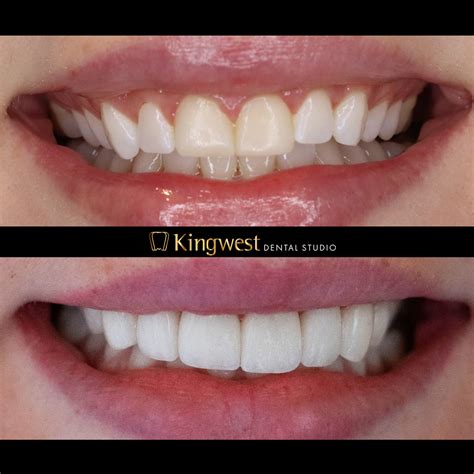 Cosmetic Dentistry Kwd Cosmetic Dentistry