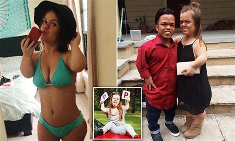 Central Coast Woman With Dwarfism Claims She S Treated Better In Bali
