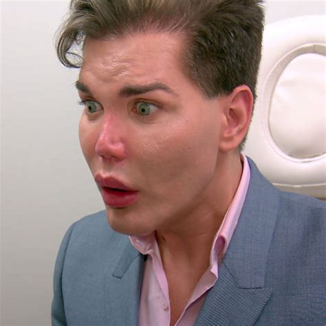 Botched Patient Rodrigo Alves Learns His Nose Could Die And Fall Off