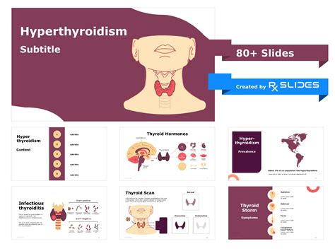 Download Hyperthyroidism Powerpoint Template Rxslides