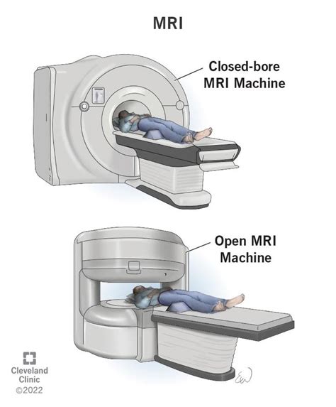 Mri Magnetic Resonance Imaging What It Is Types And Results