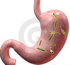 Jonas a., yahav j., soudry a. Science Info: Brief Overview of Gastroenteritis (Stomach Flu)