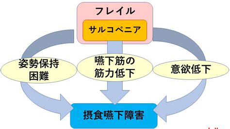 Chapter1 Peg 2適応と禁忌 2疾患別 Peg適応⑤認知症｜pdnレクチャー