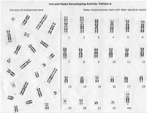 Karyotype Chromosome Lab Activity By Beverly Biology TPT