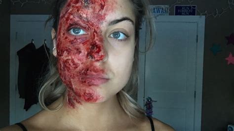 Laser hair removal is a medical procedure that uses a laser — an intense, pulsating beam of light — to remove unwanted hair. Special FX Makeup | Burnt Face 2017 - YouTube