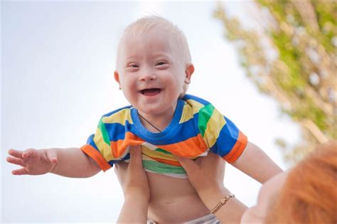 What Are The Different Types Of Down Syndrome