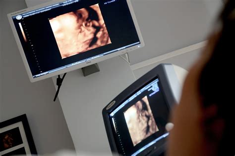 How Many Ultrasounds Do You Get During Pregnancy Experts Weigh In