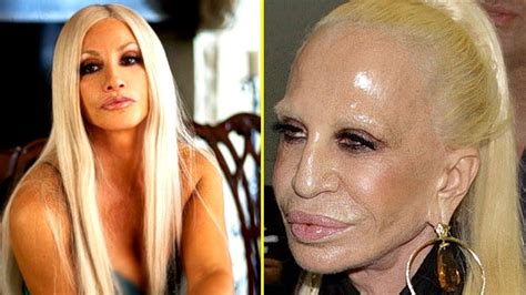 7 ridiculous cases of people taking plastic surgery too far youtube