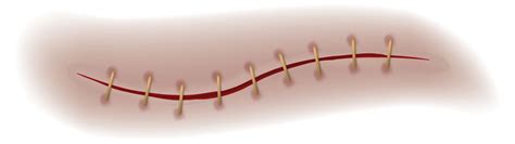 Scar Or Wound Realistic Bloody Stitch Surgical Sutures Healing Seam