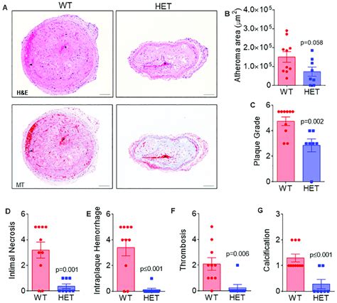 Arf6 Heterozygosity Attenuates The Size And Severity Of Oscillatory