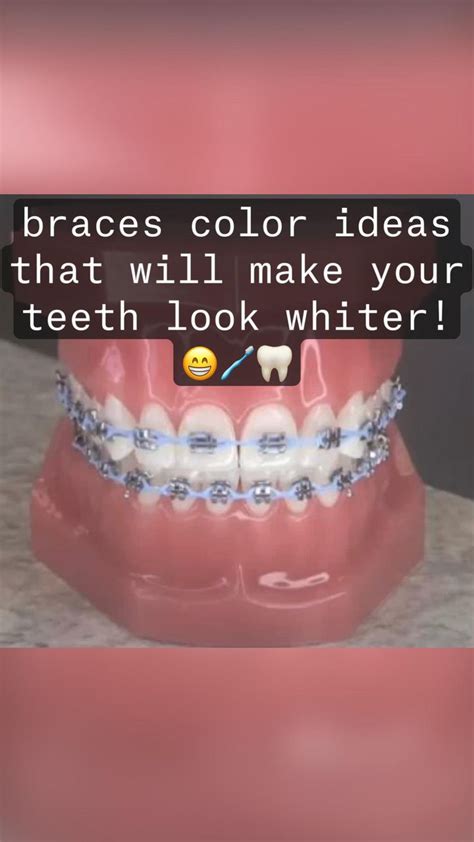 Braces Color Ideas That Will Make Your Teeth Look Whiter 😁🪥🦷 Braces