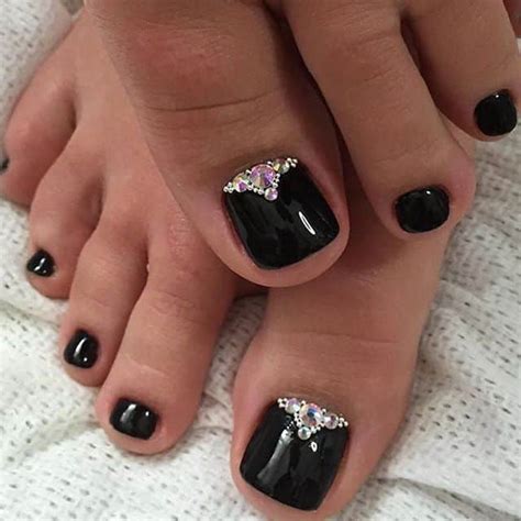 31 Awe-Inspiring Prom Nails To Make Heads Turn ... Summary of treatment options for pinky toe injuries ingrown toenails.