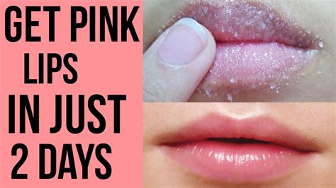 How To Get Pink Lipslighten Dark Lips Naturally Fast Diy Miracle