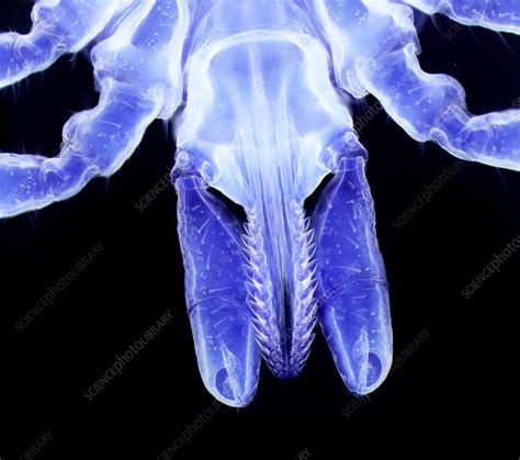 Lyme Disease Tick Mouthparts Light Micrograph Stock Image C037