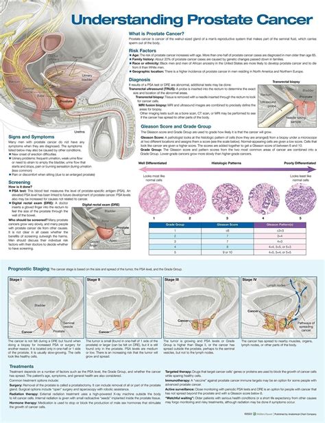 Anatomy Charts Posters Understanding Prostate Cancer Anatomical Chart Edition Third