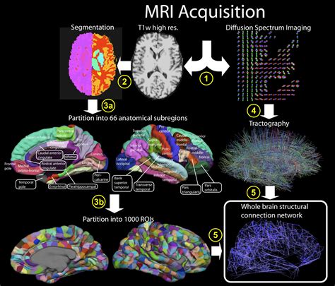 Cerebral Cortex And Its Millions Of Neural Fibers Gets A Map Science 20