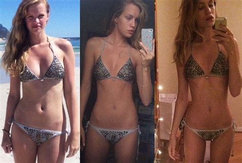 This Super Skinny 19 Year Old Was Told She Is Too FAT To Be A Model