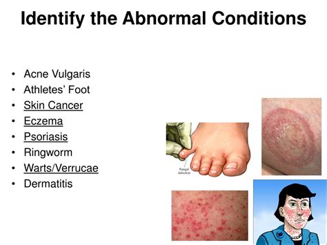 Ppt Skin Abnormalities Powerpoint Presentation Free Download Id