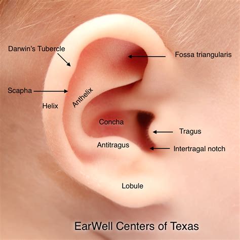 Infant Ear Deformities And Malformations Earwell Centers Of Texas