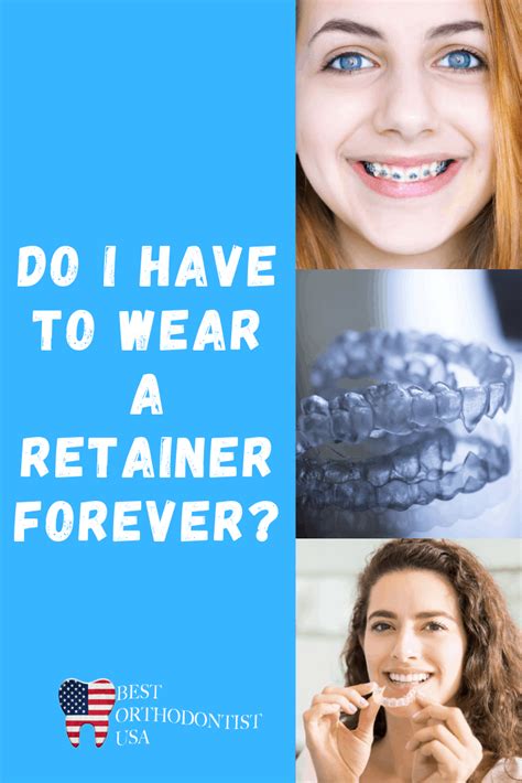 When patients get their braces off or finish invisalign, the first order of to maintain a straight smile for a lifetime, you're going to need to wear your retainers nightly for the rest of your life. Do I Have to Wear a Retainers Forever? - Best Orthodontist USA