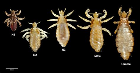 Treatment For Drug Resistant Head Lice Baystate Health Springfield Ma