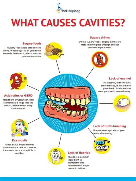 what are cavities what causes cavities [infographic]