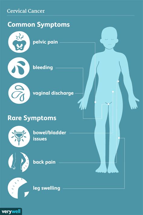 Cervical Cancer Signs Symptoms And Complications