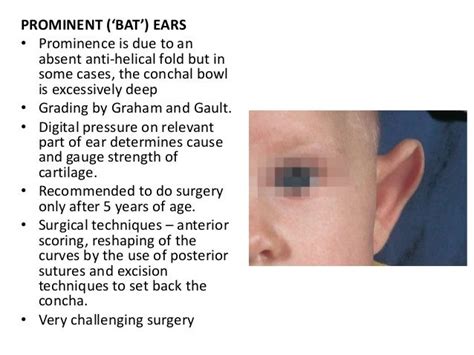 Congenital Malformation Of External Ear And Its Management