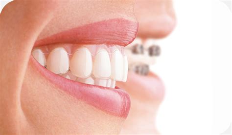 Tratamientos Dentales Implantes Periodoncia Estética Dental