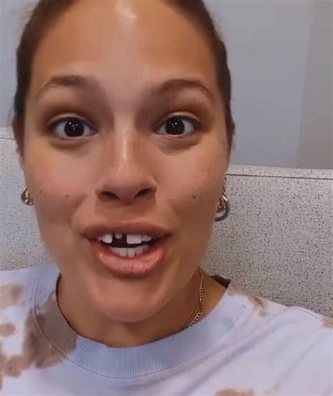 Ashley Graham Shows Off Broken Tooth After Frozen Cookie Mishap E