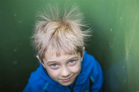 Uncombable Hair Syndrome What To Know About This Rare Condition