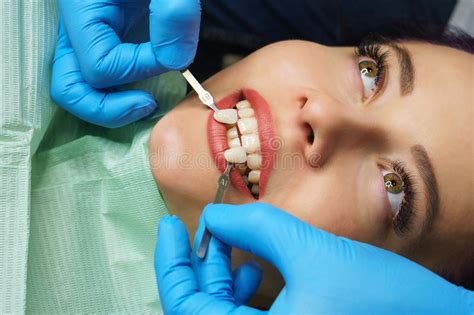 Teeth Whitening Stock Image Image Of Female Hygiene 141045201