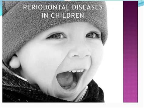 Eruption Gingivitis And Pericoronitis In Children