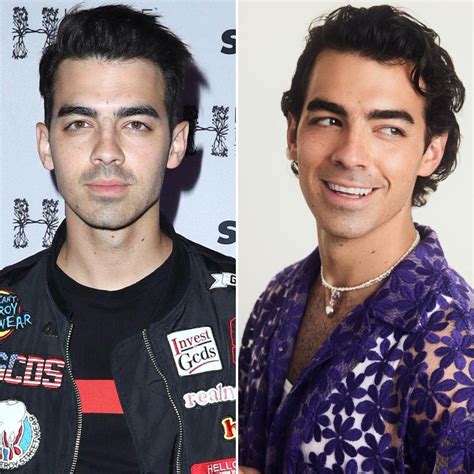Did Joe Jonas Get Plastic Surgery See Before And After Photos Of The Jonas Brother