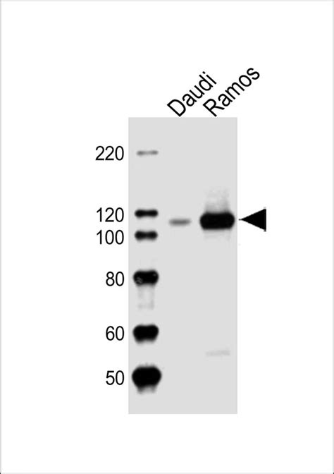 ptk2b antibody c term purified rabbit polyclonal antibody pab ihc p wb buy now