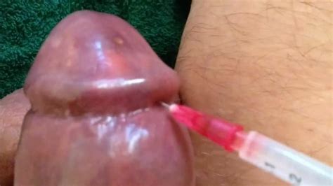Bdsm Silicone Injections New Porn Photos
