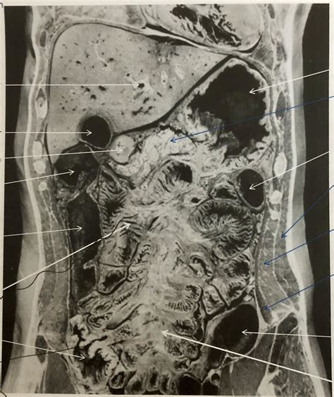 Coronal And Sagittal Image 15 Diagram Quizlet