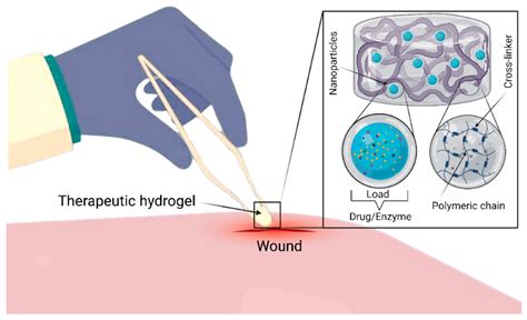 Gels Free Full Text Nanoclaypolymer Based Hydrogels And Enzyme