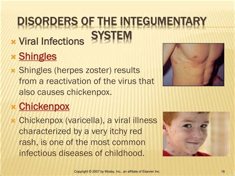 Ppt Chapter 10 Integumentary System Powerpoint Presentation Free