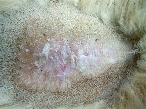 Skin Lesions Scalp Lesions Pustular Extensive Erosions Quiz Case