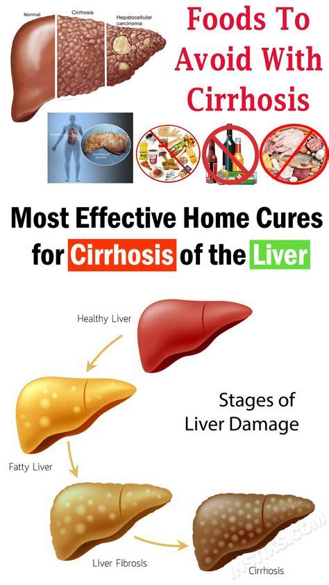 10 Cirrhosis Diet Recipes Ideas Fatty Liver Diet Liver Diet